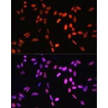 Immunofluorescence - Anti-Histone H3 (Phospho T6) Antibody (A92839) - Antibodies.com