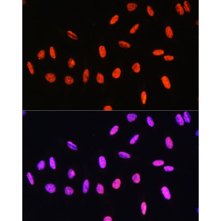 Immunofluorescence - Anti-Histone H3 (Phospho T6) Antibody (A92839) - Antibodies.com