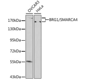 Western Blot - Anti-BRG1 Antibody (A92840) - Antibodies.com