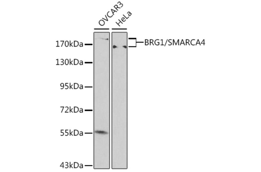 Western Blot - Anti-BRG1 Antibody (A92840) - Antibodies.com