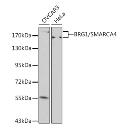 Western Blot - Anti-BRG1 Antibody (A92840) - Antibodies.com