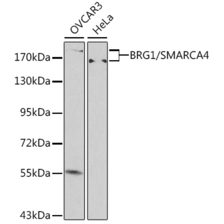Western Blot - Anti-BRG1 Antibody (A92840) - Antibodies.com