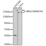 Western Blot - Anti-BRG1 Antibody (A92840) - Antibodies.com