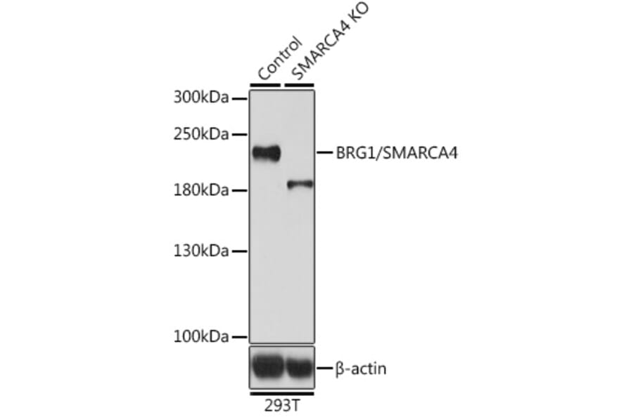 Western Blot - Anti-BRG1 Antibody (A92840) - Antibodies.com