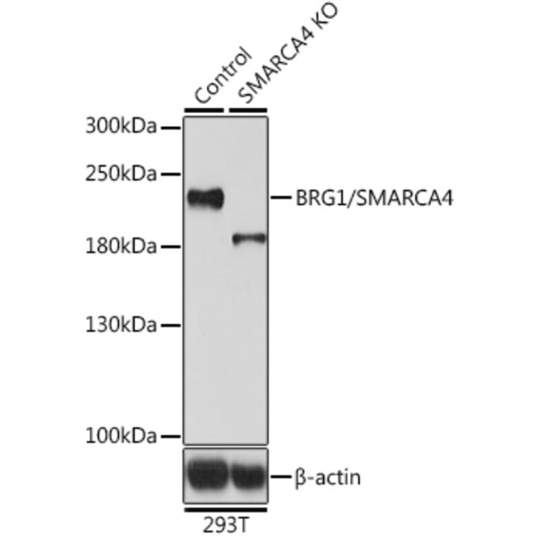 Western Blot - Anti-BRG1 Antibody (A92840) - Antibodies.com