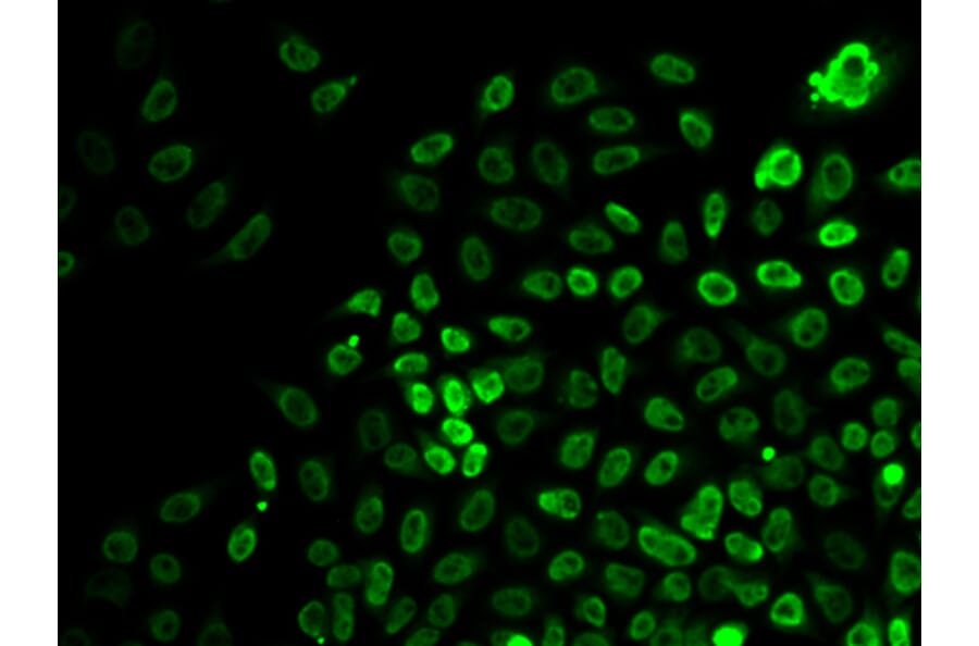 Immunofluorescence - Anti-BRG1 Antibody (A92840) - Antibodies.com