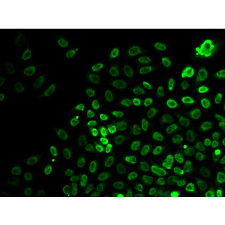 Immunofluorescence - Anti-BRG1 Antibody (A92840) - Antibodies.com