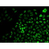 Immunofluorescence - Anti-BRG1 Antibody (A92840) - Antibodies.com