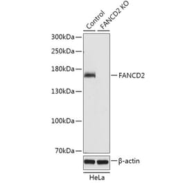 Western Blot - Anti-FANCD2 Antibody (A92841) - Antibodies.com