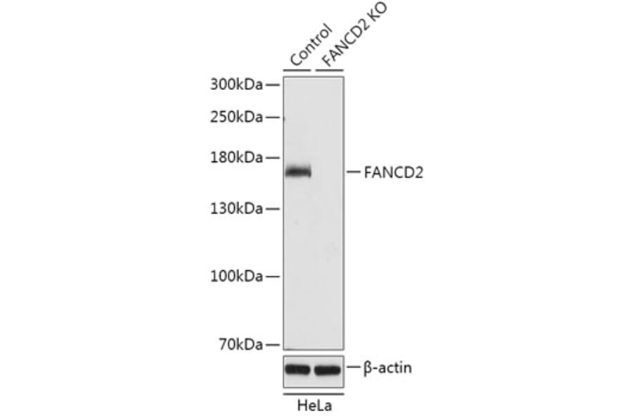 Western Blot - Anti-FANCD2 Antibody (A92841) - Antibodies.com