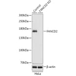 Western Blot - Anti-FANCD2 Antibody (A92841) - Antibodies.com