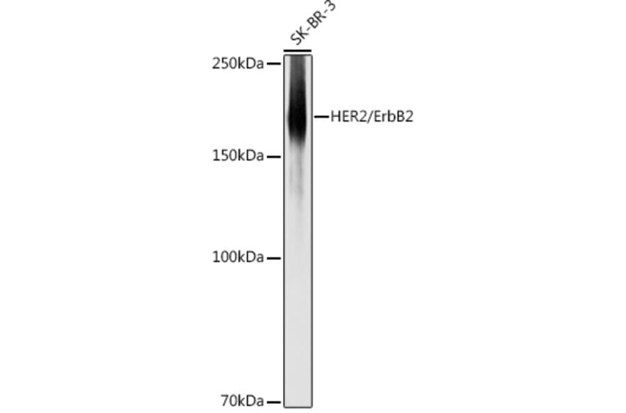 Western Blot - Anti-ErbB2/HER2 Antibody (A92843) - Antibodies.com