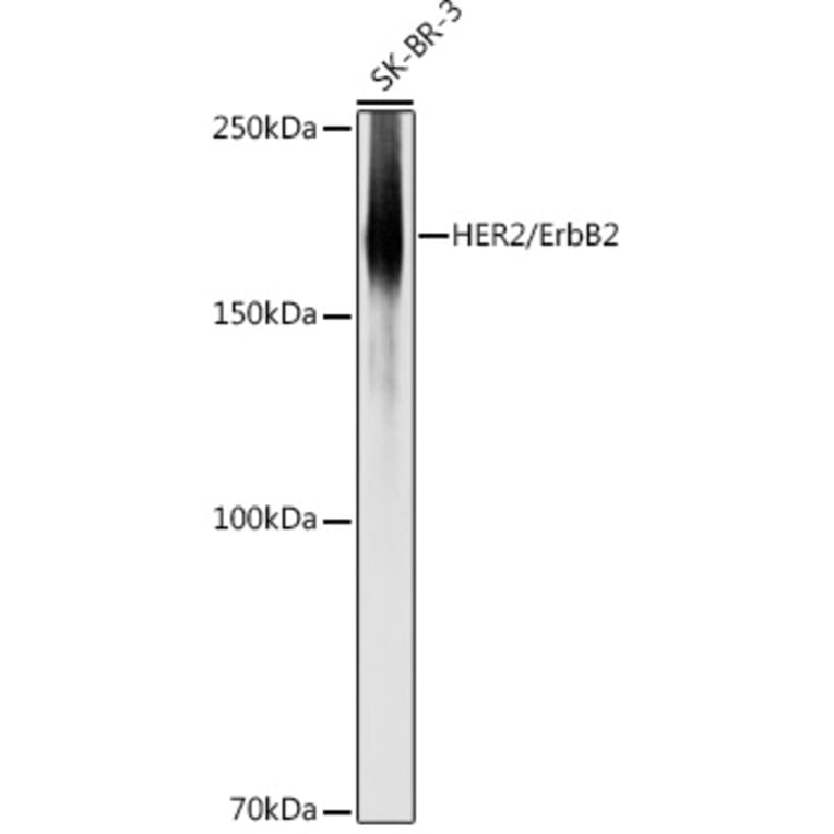 Western Blot - Anti-ErbB2/HER2 Antibody (A92843) - Antibodies.com