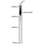 Western Blot - Anti-ErbB2/HER2 Antibody (A92843) - Antibodies.com