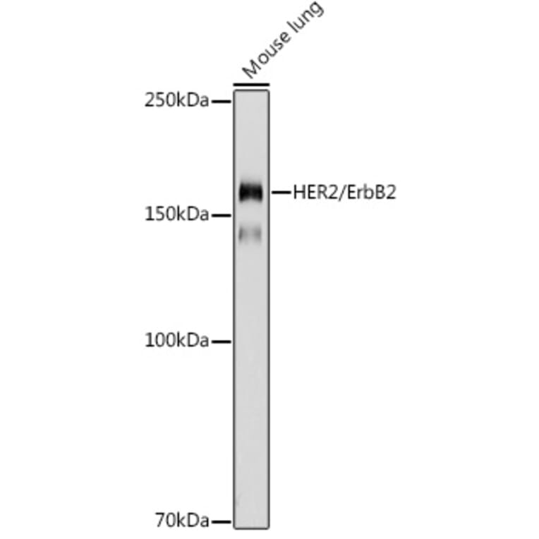 Western Blot - Anti-ErbB2/HER2 Antibody (A92843) - Antibodies.com