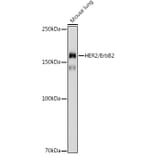 Western Blot - Anti-ErbB2/HER2 Antibody (A92843) - Antibodies.com