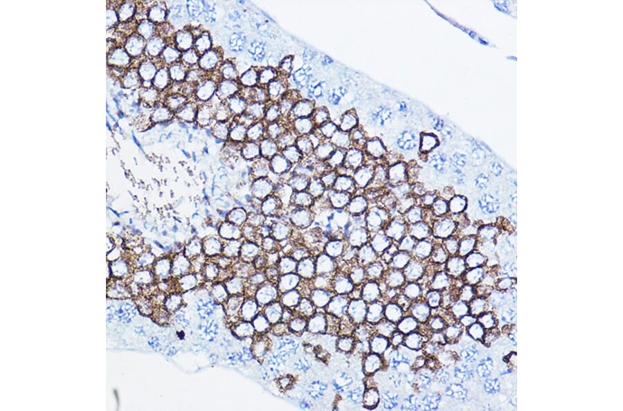 Immunohistochemistry - Anti-ErbB2/HER2 Antibody (A92843) - Antibodies.com
