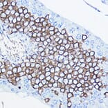 Immunohistochemistry - Anti-ErbB2/HER2 Antibody (A92843) - Antibodies.com