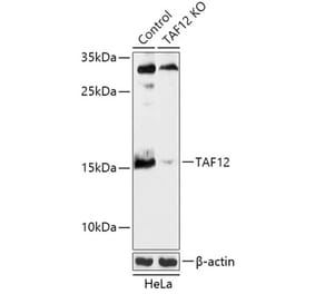 Western Blot - Anti-TAF12 Antibody (A92845) - Antibodies.com