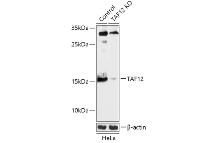 Western Blot - Anti-TAF12 Antibody (A92845) - Antibodies.com