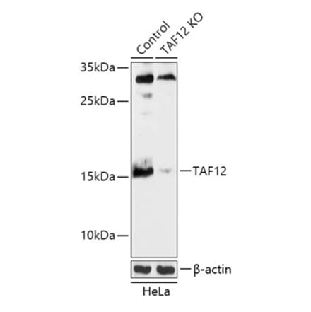 Western Blot - Anti-TAF12 Antibody (A92845) - Antibodies.com