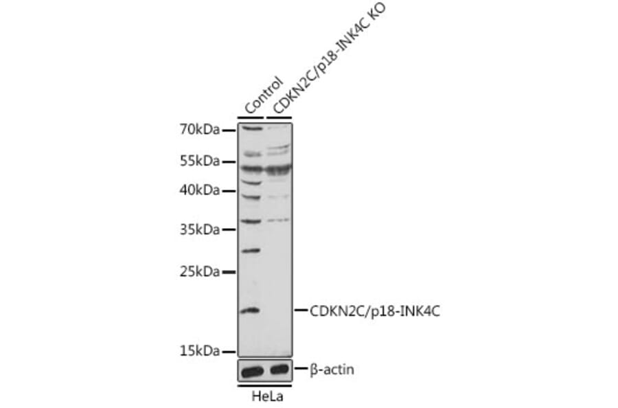 Western Blot - Anti-p18 INK4c / CDKN2C Antibody (A92846) - Antibodies.com