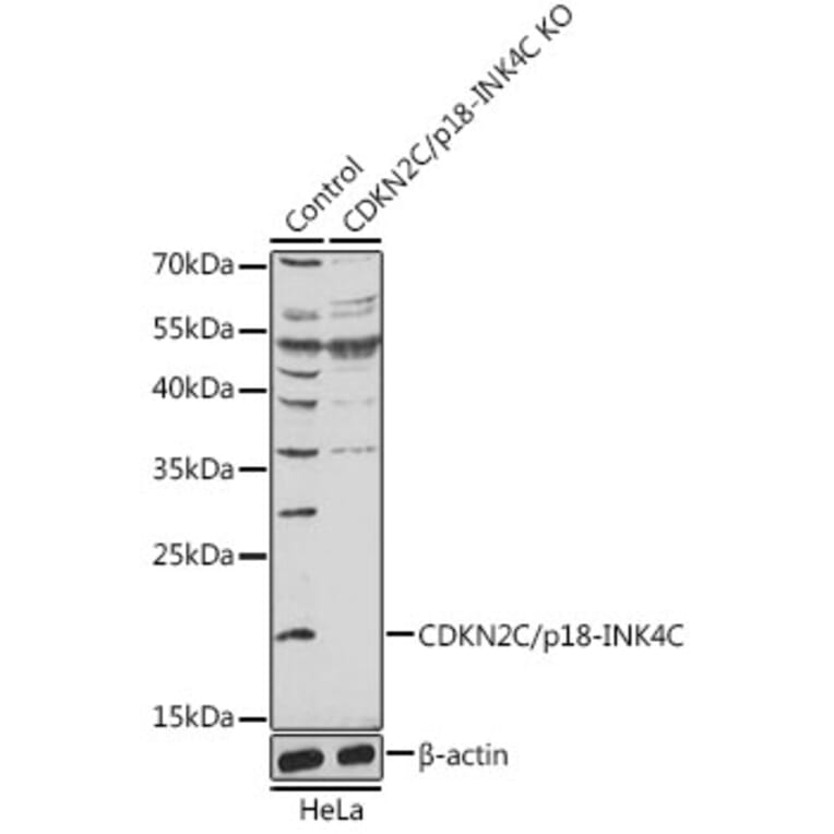 Western Blot - Anti-p18 INK4c / CDKN2C Antibody (A92846) - Antibodies.com