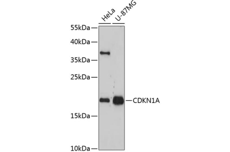 Western Blot - Anti-CDKN1A Antibody (A11877) - Antibodies.com