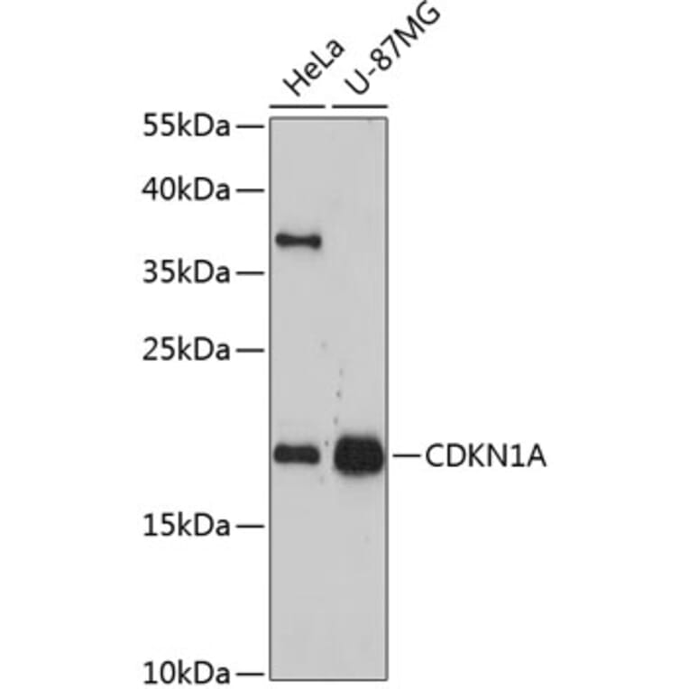 Western Blot - Anti-CDKN1A Antibody (A11877) - Antibodies.com