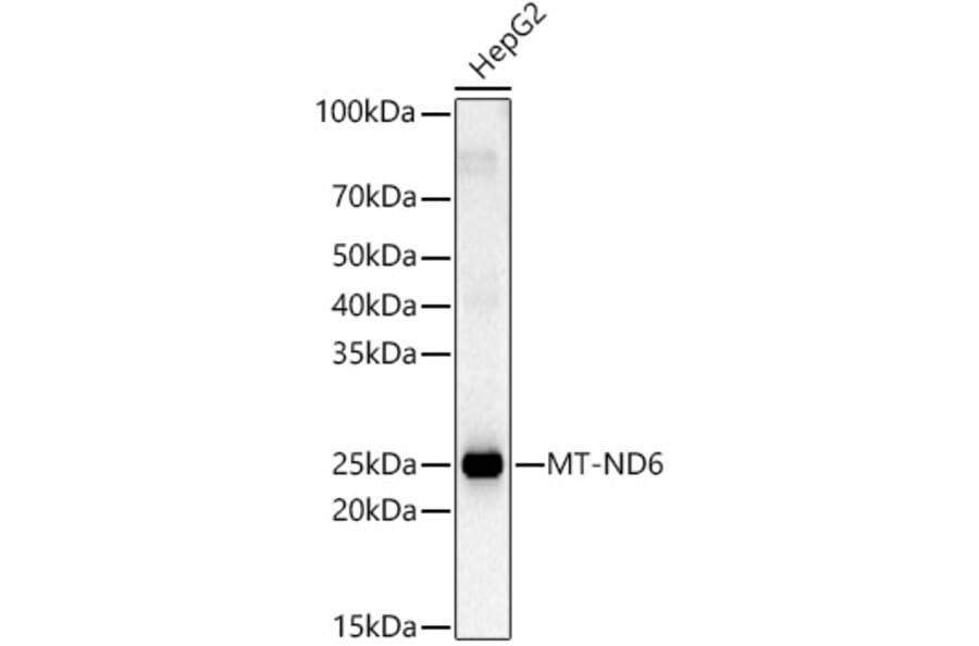 Western Blot - Anti-ND6 Antibody (A92852) - Antibodies.com