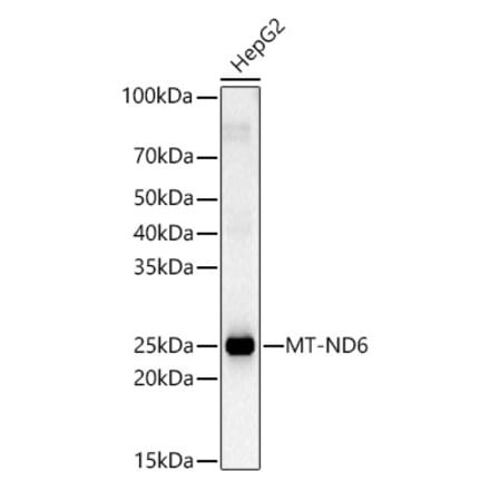 Western Blot - Anti-ND6 Antibody (A92852) - Antibodies.com