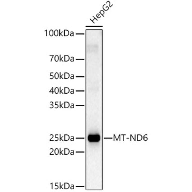 Western Blot - Anti-ND6 Antibody (A92852) - Antibodies.com