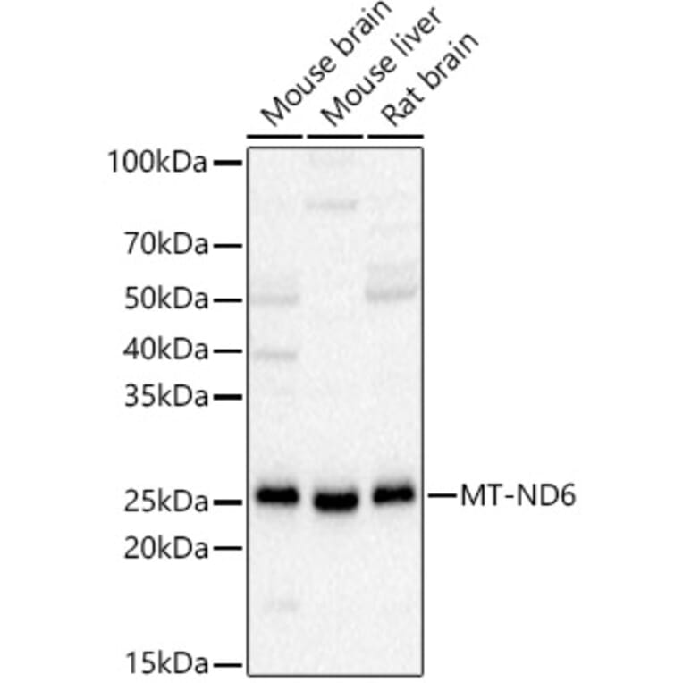 Western Blot - Anti-ND6 Antibody (A92852) - Antibodies.com