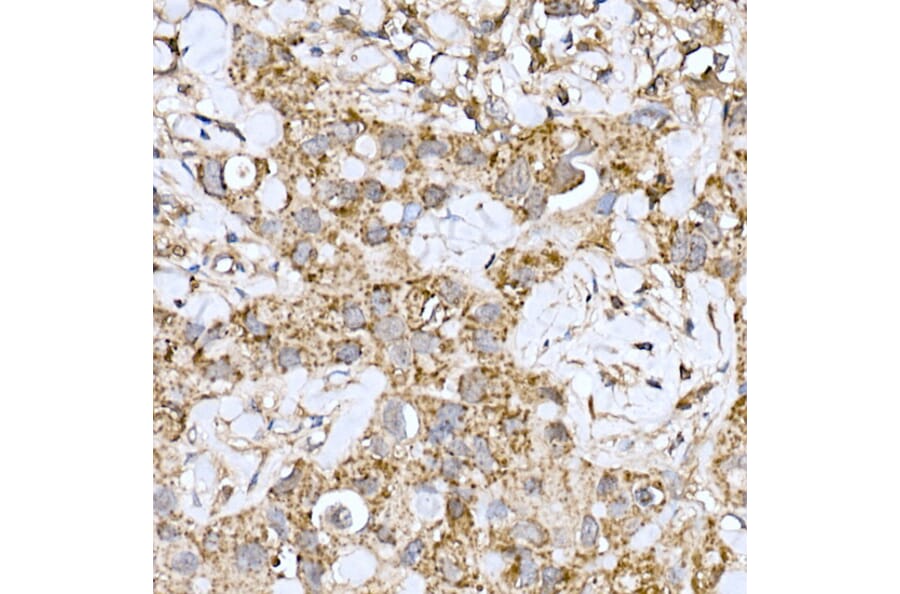 Immunohistochemistry - Anti-ND6 Antibody (A92852) - Antibodies.com