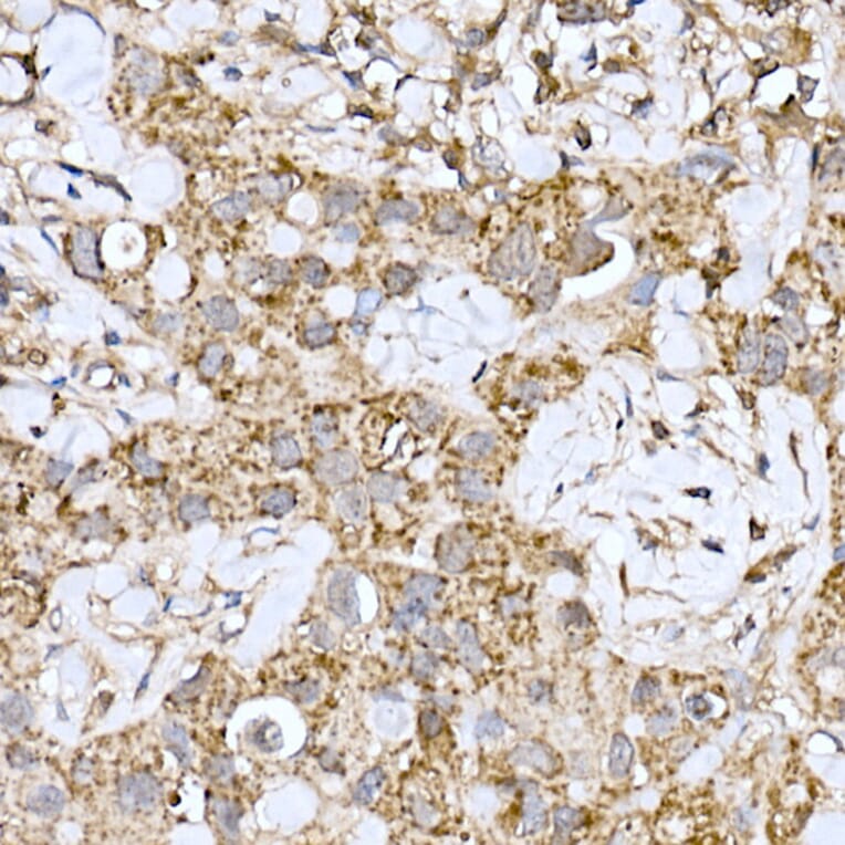 Immunohistochemistry - Anti-ND6 Antibody (A92852) - Antibodies.com