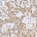 Immunohistochemistry - Anti-ND6 Antibody (A92852) - Antibodies.com