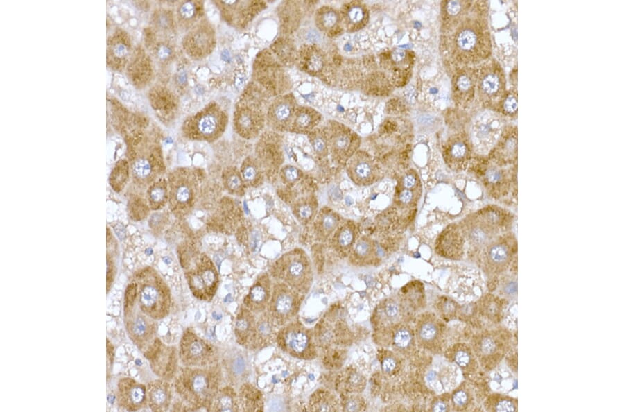 Immunohistochemistry - Anti-ND6 Antibody (A92852) - Antibodies.com