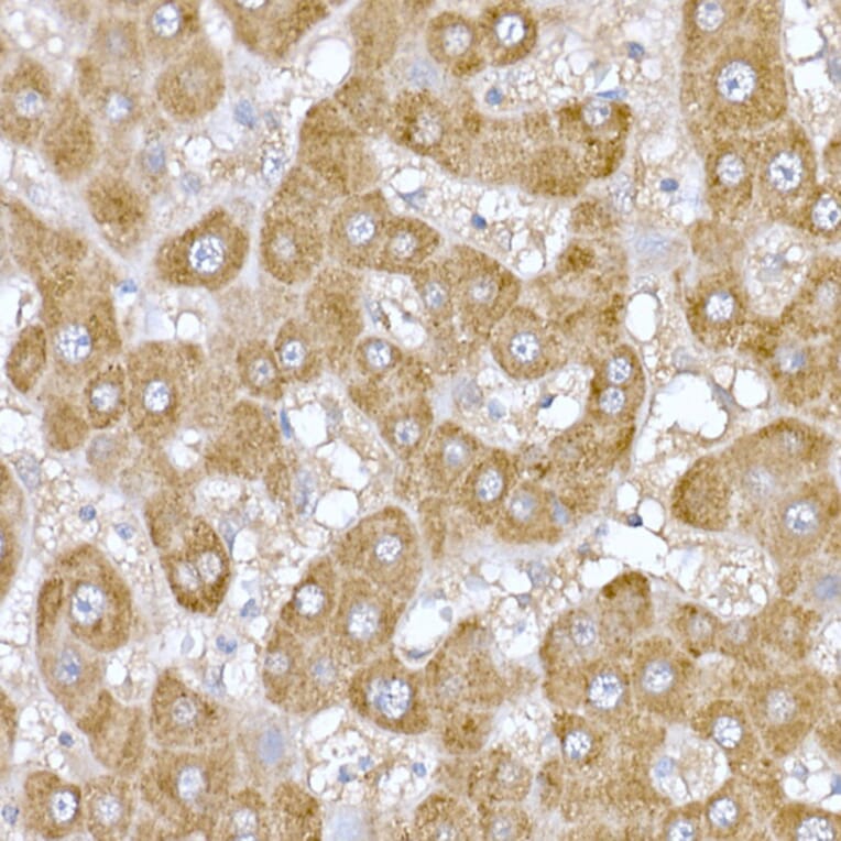 Immunohistochemistry - Anti-ND6 Antibody (A92852) - Antibodies.com