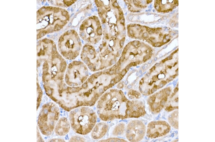 Immunohistochemistry - Anti-ND6 Antibody (A92852) - Antibodies.com