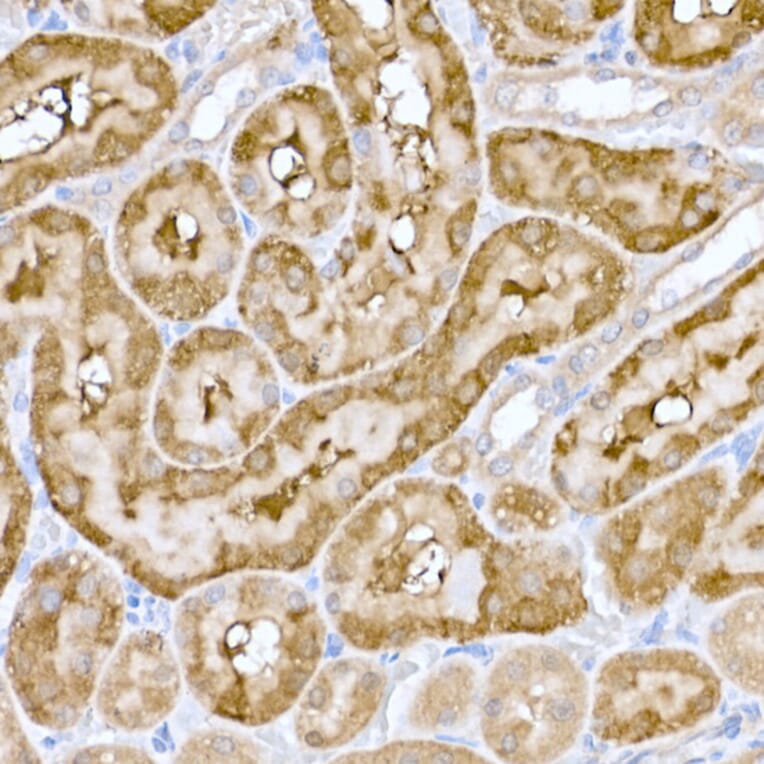Immunohistochemistry - Anti-ND6 Antibody (A92852) - Antibodies.com