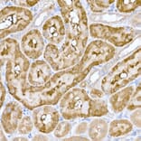 Immunohistochemistry - Anti-ND6 Antibody (A92852) - Antibodies.com