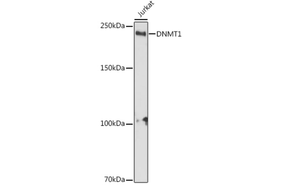 Western Blot - Anti-Dnmt1 Antibody (A92854) - Antibodies.com