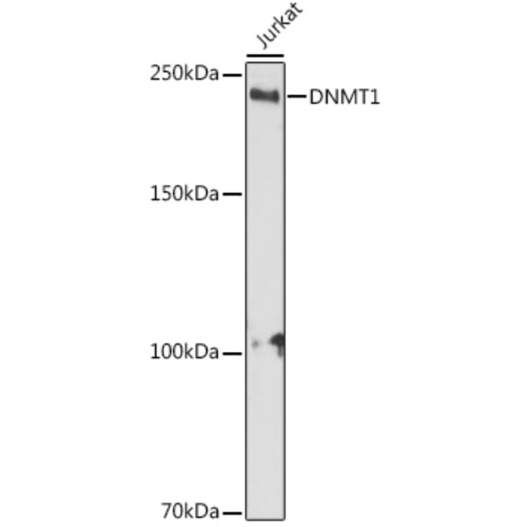 Western Blot - Anti-Dnmt1 Antibody (A92854) - Antibodies.com