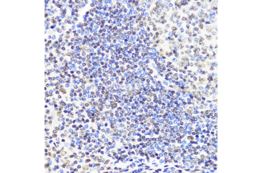 Immunohistochemistry - Anti-Dnmt1 Antibody (A92854) - Antibodies.com