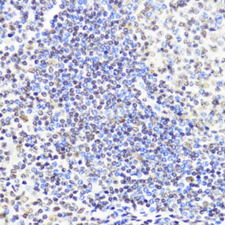 Immunohistochemistry - Anti-Dnmt1 Antibody (A92854) - Antibodies.com
