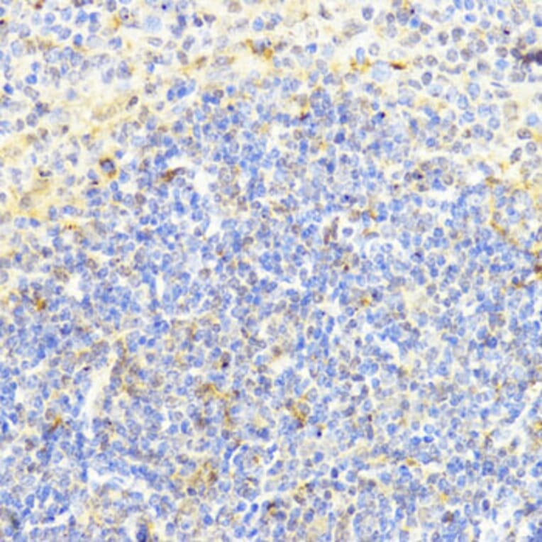 Immunohistochemistry - Anti-Dnmt1 Antibody (A92854) - Antibodies.com