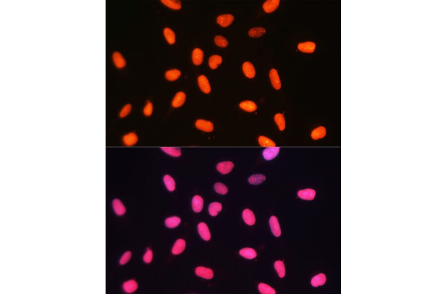 Immunofluorescence - Anti-Dnmt1 Antibody (A92854) - Antibodies.com