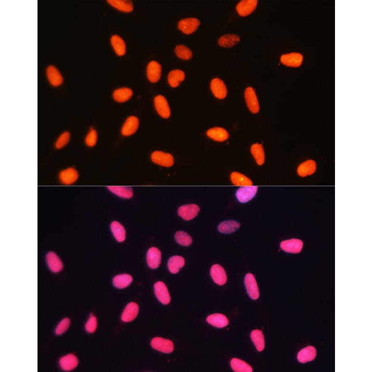 Immunofluorescence - Anti-Dnmt1 Antibody (A92854) - Antibodies.com