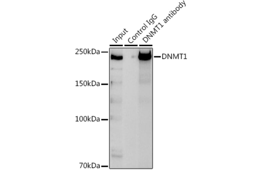 Western Blot - Anti-Dnmt1 Antibody (A92854) - Antibodies.com
