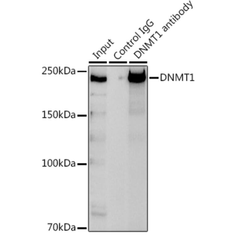 Western Blot - Anti-Dnmt1 Antibody (A92854) - Antibodies.com